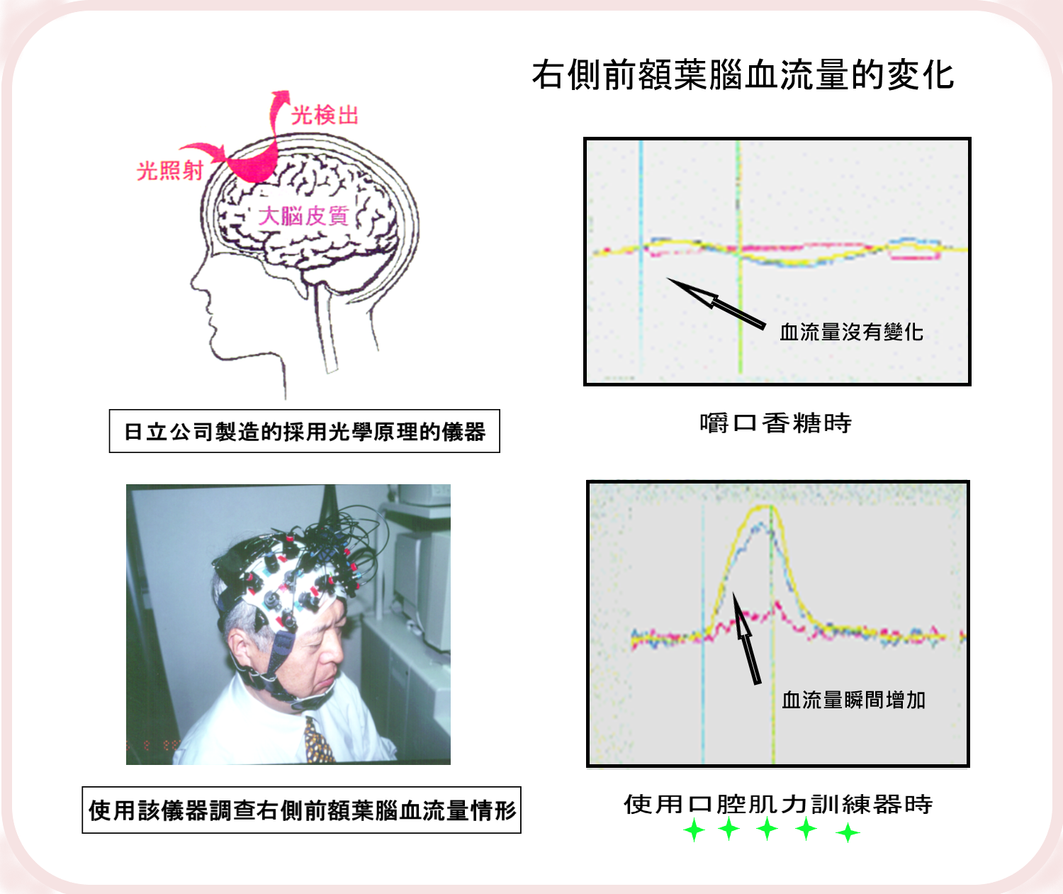 使用Patakara 巴拉康達訓練的影響?